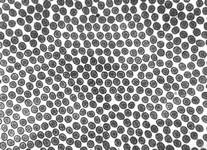 normal mucosa - jejunum - microvilli normal mucosa - jejunum - microvilli